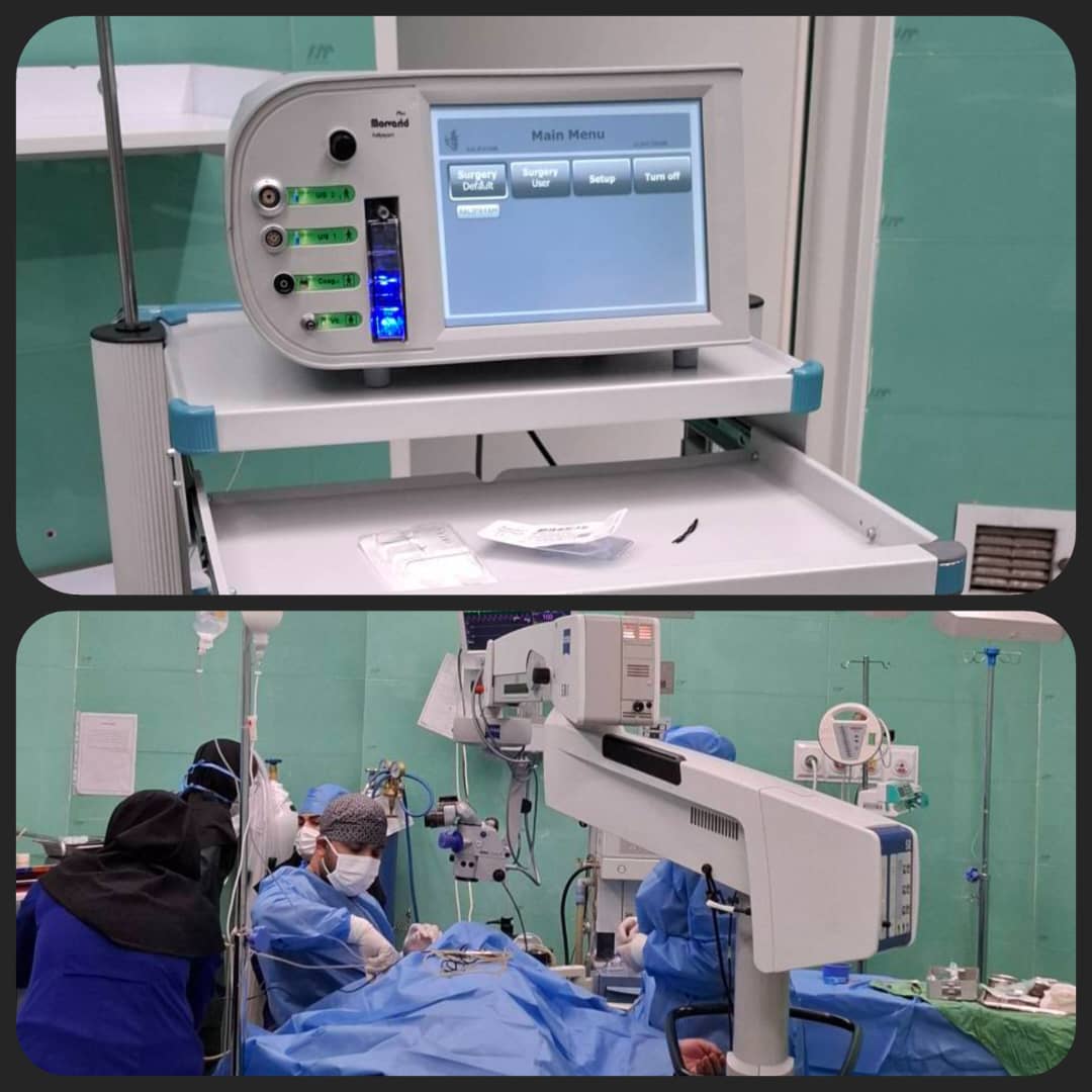 پایان ۴ سال محرومیت از جراحی چشم در رباط‌کریم با نسل جدید دستگاه فیکو